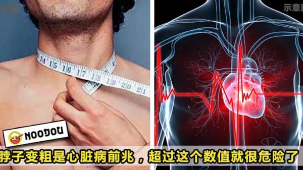 jeart disease