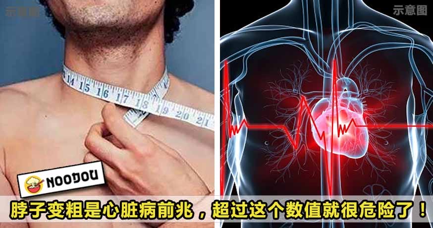 jeart disease