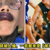 Mouth Bengkak Featured
