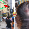 Shop Signboard Fell Hit Customer Feature Image