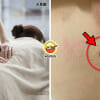 Massage Half Mole Ripped Off Feature Image