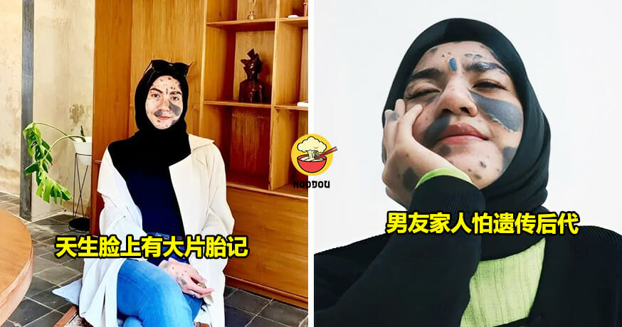 Ft img lastest 胎记